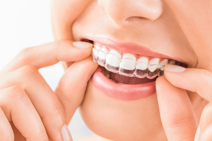 orthodontic treatment in jaipur