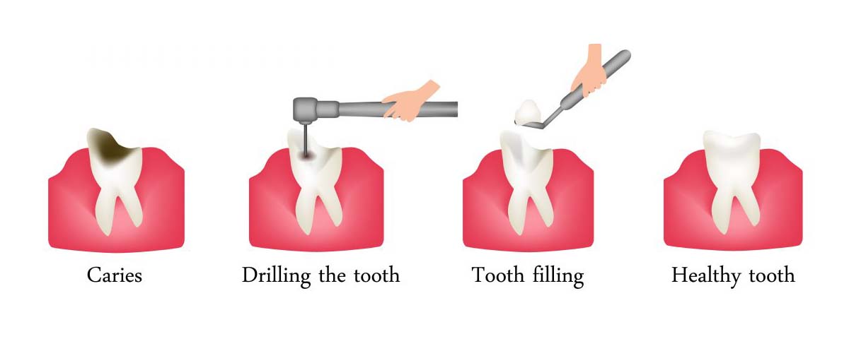 tooth feeling